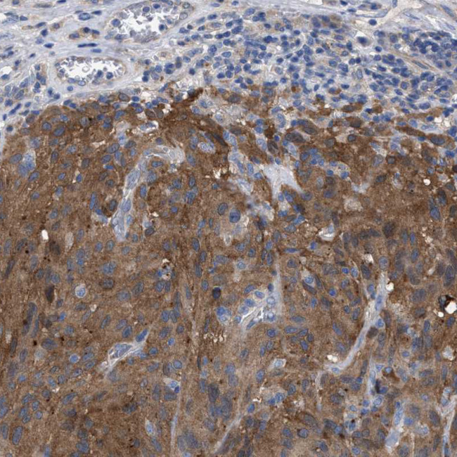 GMPR Antibody in Immunohistochemistry (IHC)