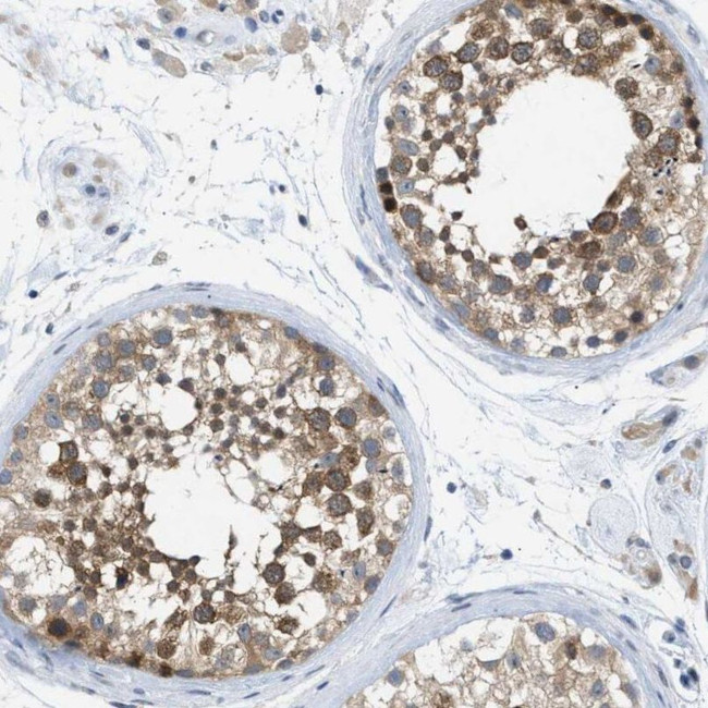 WIPI2 Antibody in Immunohistochemistry (IHC)