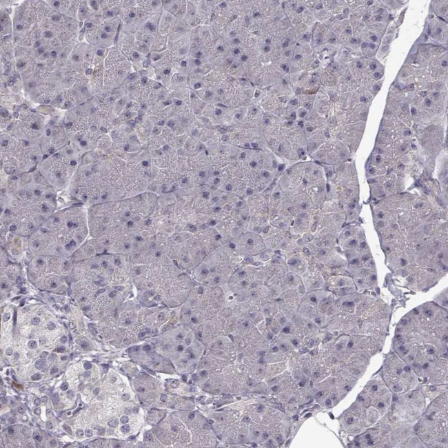 ENTPD8 Antibody in Immunohistochemistry (IHC)