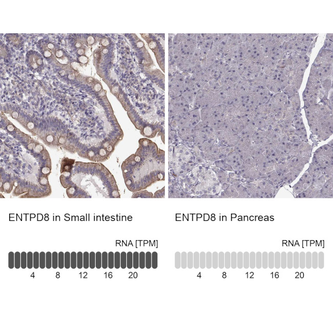 ENTPD8 Antibody