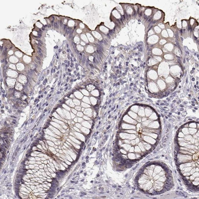 ENTPD8 Antibody in Immunohistochemistry (IHC)