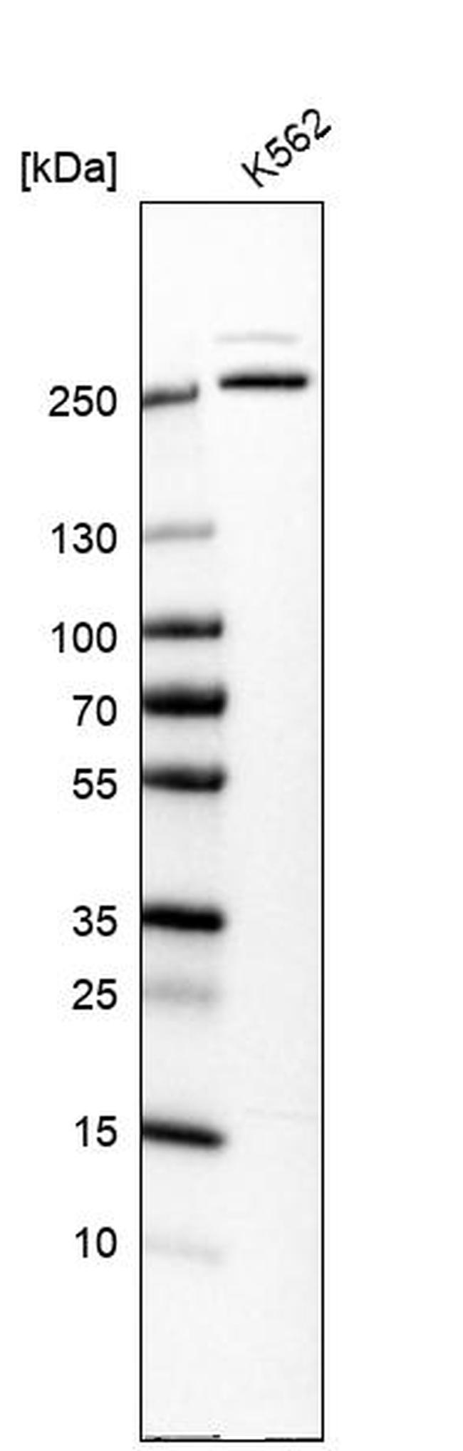 GANP Antibody in Western Blot (WB)