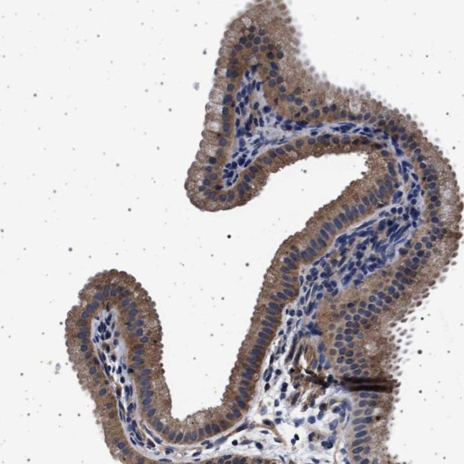 MEKK2 Antibody in Immunohistochemistry (IHC)