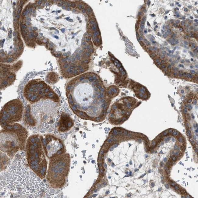 TPK1 Antibody in Immunohistochemistry (IHC)