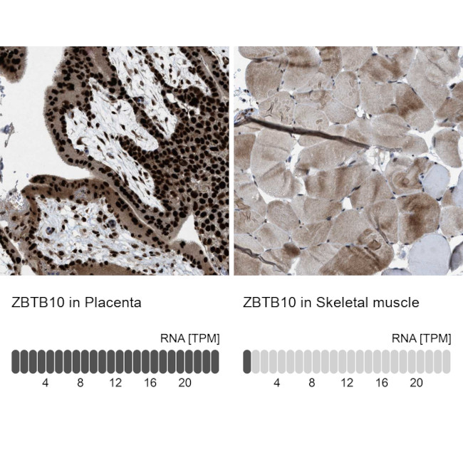 ZBTB10 Antibody