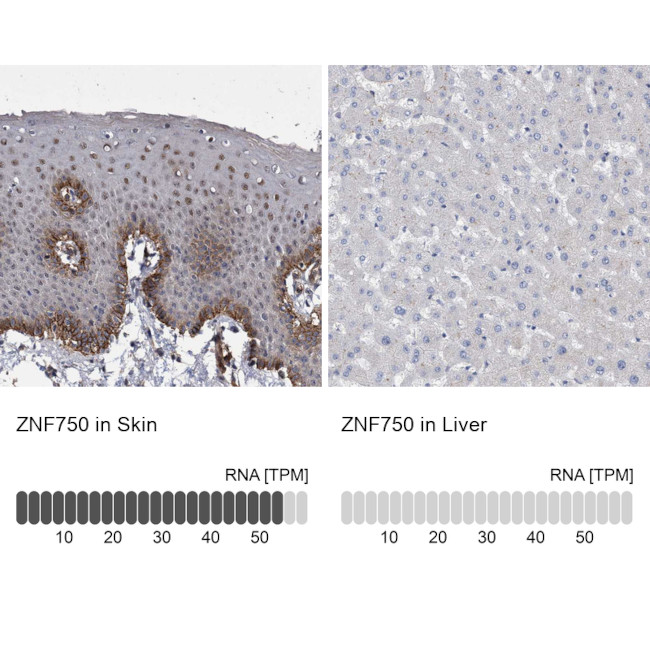 ZNF750 Antibody in Immunohistochemistry (IHC)