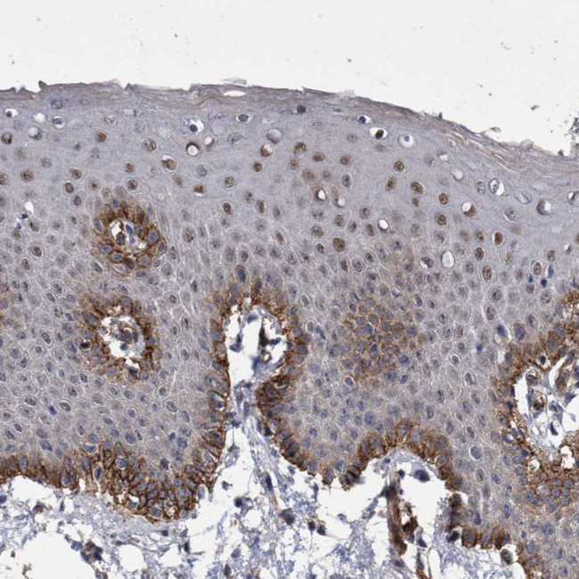 ZNF750 Antibody in Immunohistochemistry (IHC)