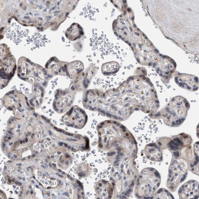 ZNF750 Antibody in Immunohistochemistry (IHC)