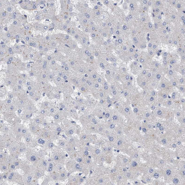 ZNF750 Antibody in Immunohistochemistry (IHC)