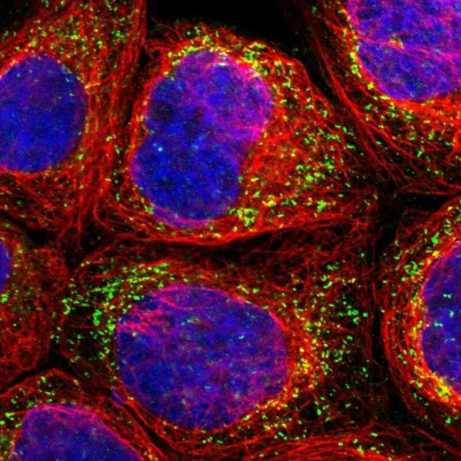 PECR Antibody in Immunocytochemistry (ICC/IF)