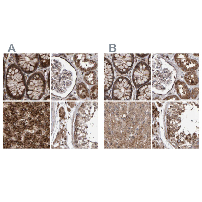 PECR Antibody in Immunohistochemistry (IHC)