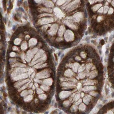 PECR Antibody in Immunohistochemistry (IHC)