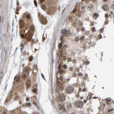 PECR Antibody in Immunohistochemistry (IHC)