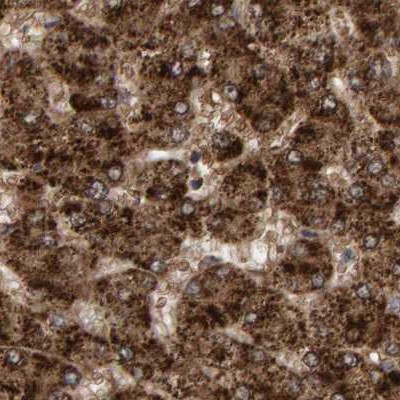 PECR Antibody in Immunohistochemistry (IHC)