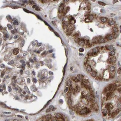 PECR Antibody in Immunohistochemistry (IHC)