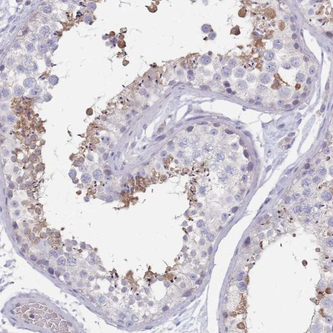 RAB11FIP4 Antibody in Immunohistochemistry (IHC)