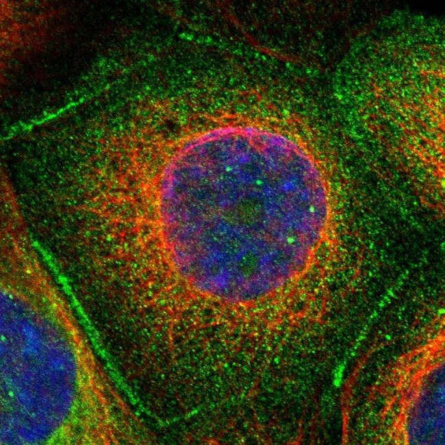 53BP2 Antibody in Immunocytochemistry (ICC/IF)