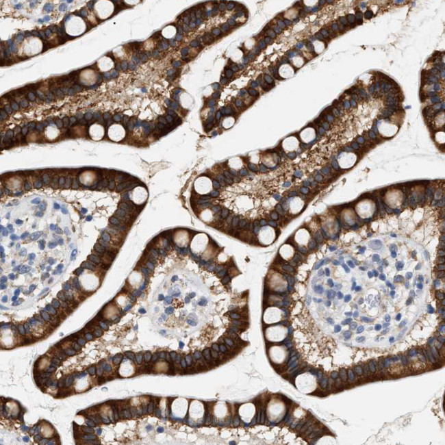 HSD17B11 Antibody in Immunohistochemistry (IHC)