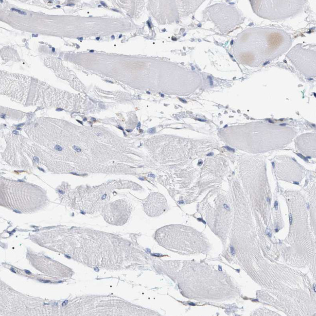 HSD17B11 Antibody in Immunohistochemistry (IHC)