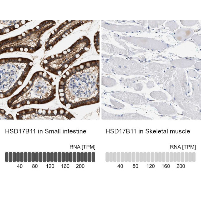 HSD17B11 Antibody