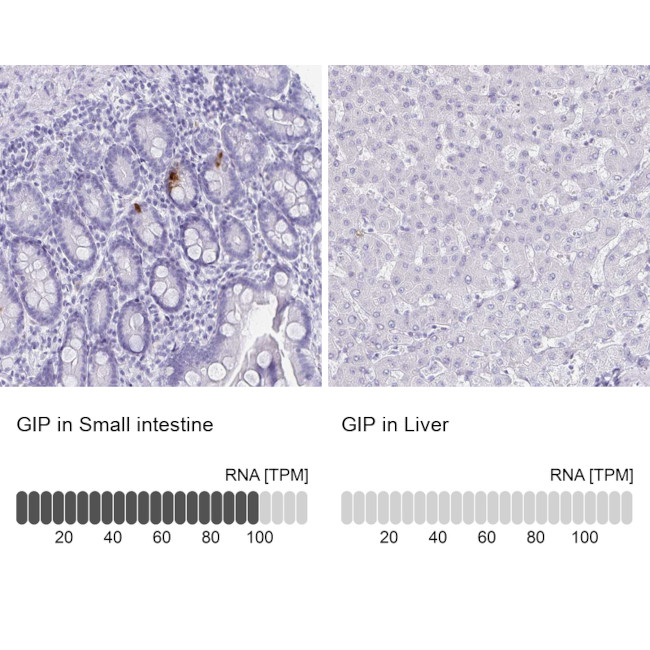 GIP Antibody in Immunohistochemistry (IHC)