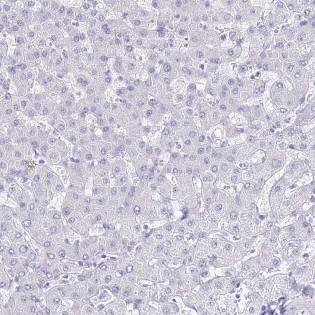 GIP Antibody in Immunohistochemistry (IHC)