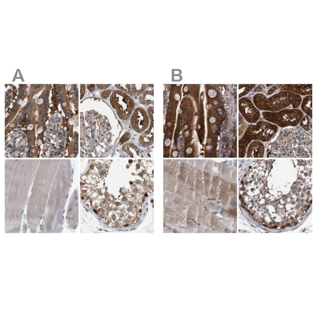 C17orf25 Antibody in Immunohistochemistry (IHC)