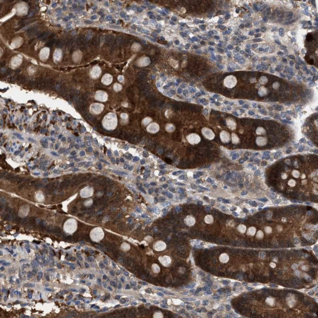 C17orf25 Antibody in Immunohistochemistry (IHC)