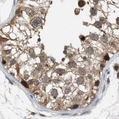 C17orf25 Antibody in Immunohistochemistry (IHC)