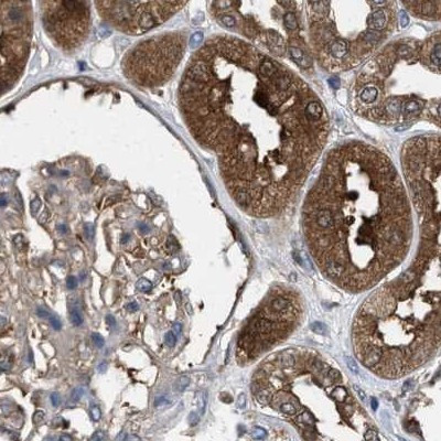 C17orf25 Antibody in Immunohistochemistry (IHC)