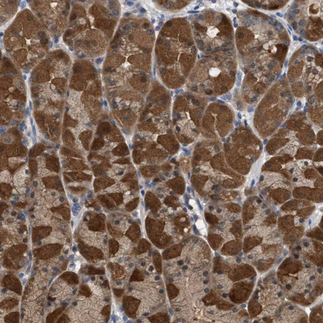 C17orf25 Antibody in Immunohistochemistry (IHC)