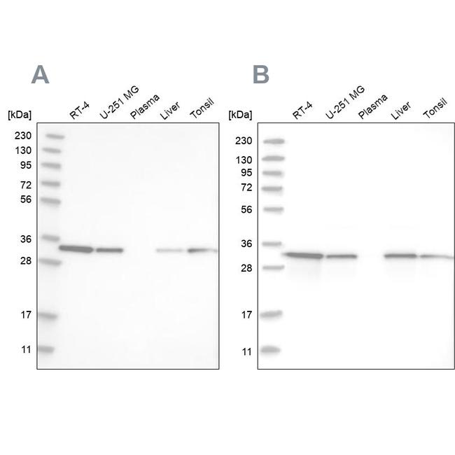 C17orf25 Antibody in Western Blot (WB)