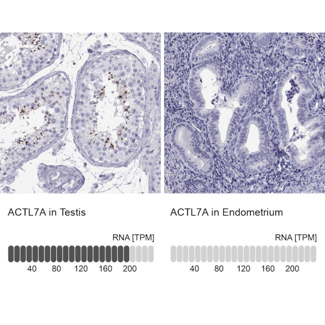 Actin-like 7A Antibody in Immunohistochemistry (IHC)