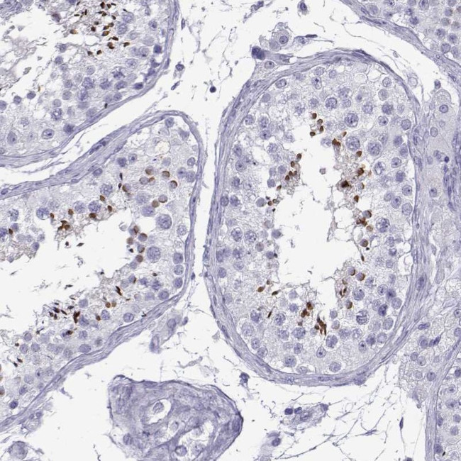 Actin-like 7A Antibody in Immunohistochemistry (IHC)