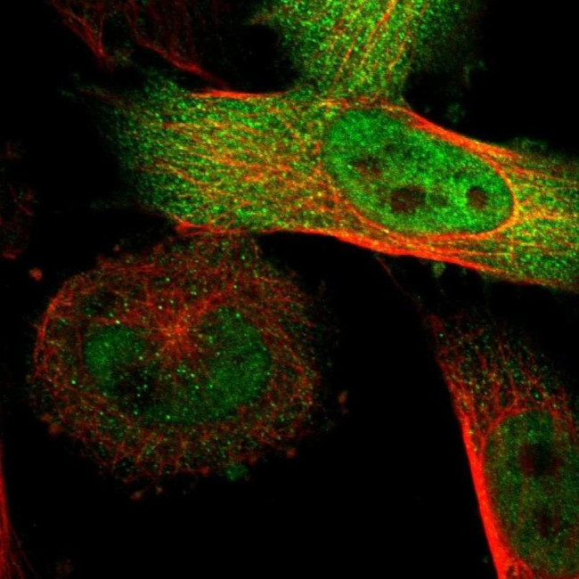 SGSM2 Antibody in Immunocytochemistry (ICC/IF)