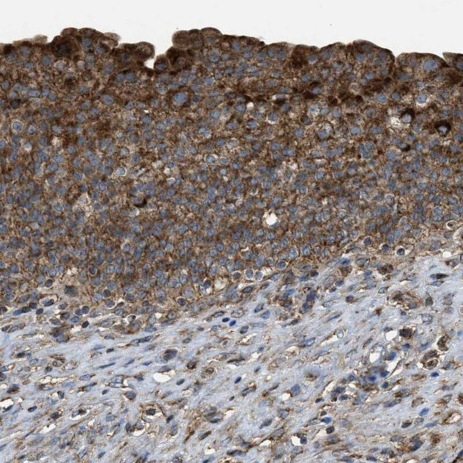 P3 Antibody in Immunohistochemistry (IHC)