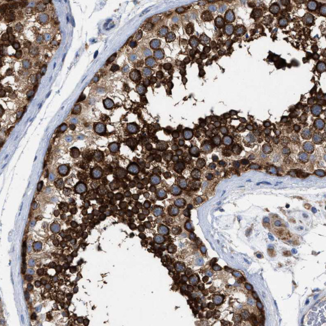 VPS13A Antibody in Immunohistochemistry (IHC)