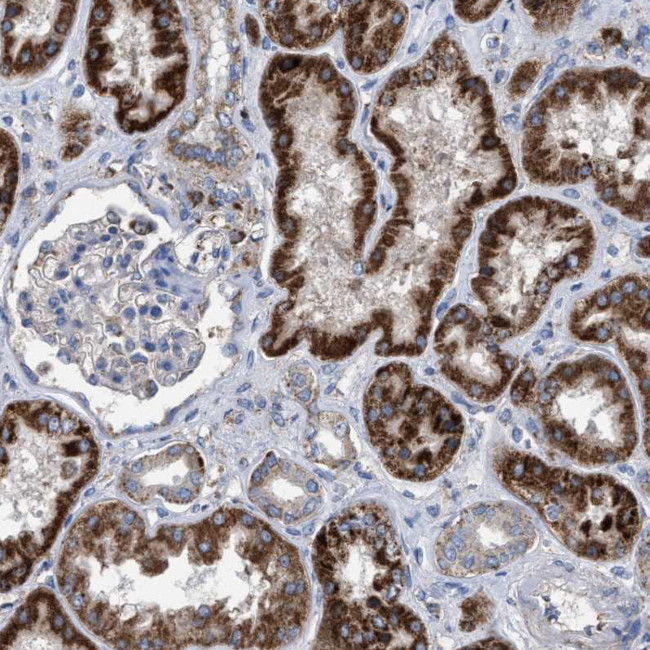 VPS13A Antibody in Immunohistochemistry (IHC)