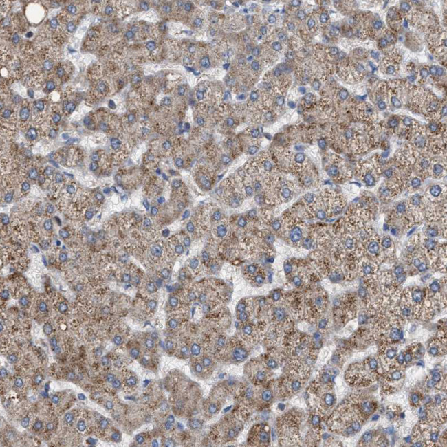 VPS13A Antibody in Immunohistochemistry (IHC)