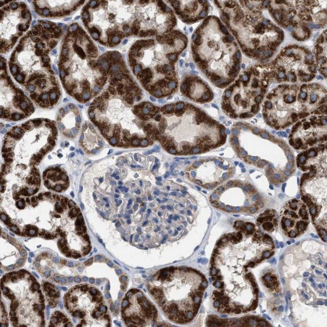 VPS13A Antibody in Immunohistochemistry (IHC)