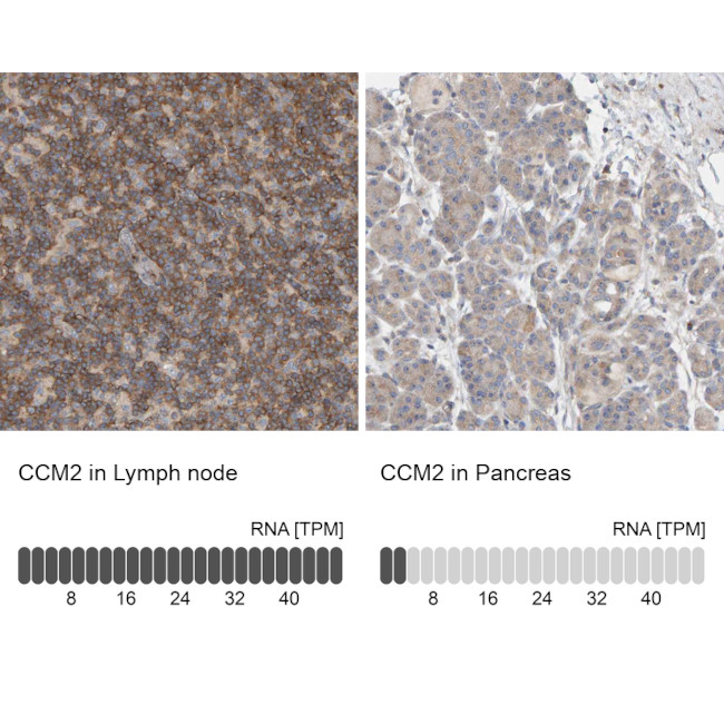 CCM2 Antibody in Immunohistochemistry (IHC)