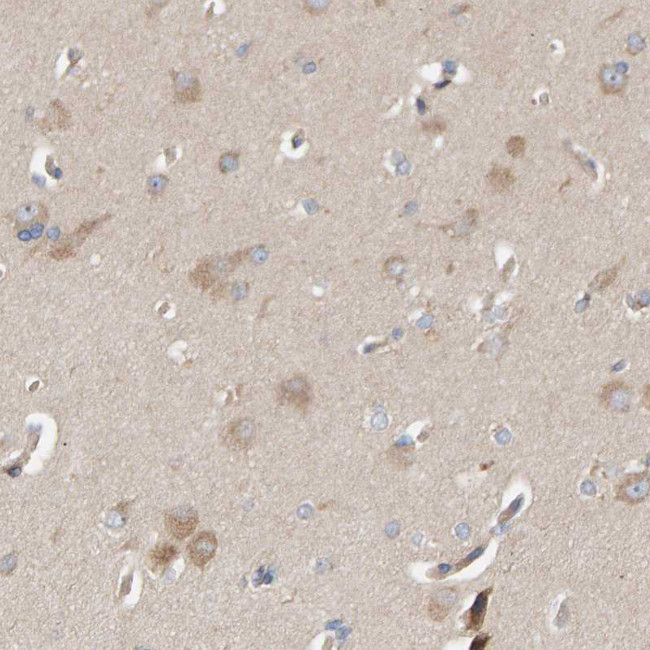 CCM2 Antibody in Immunohistochemistry (IHC)