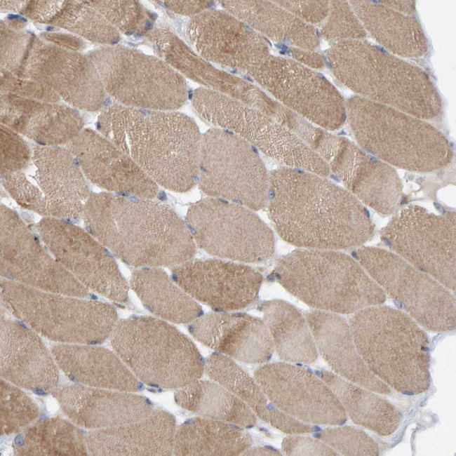 CCM2 Antibody in Immunohistochemistry (IHC)