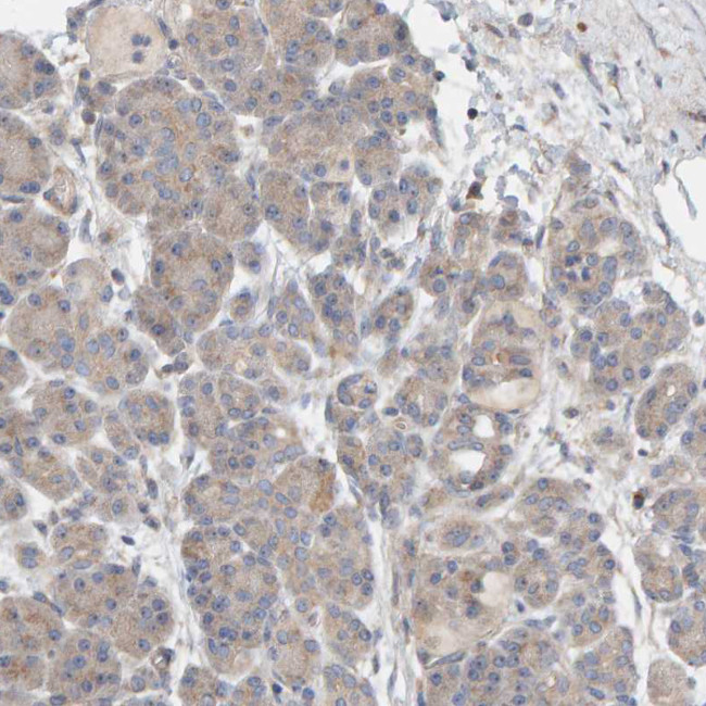 CCM2 Antibody in Immunohistochemistry (IHC)