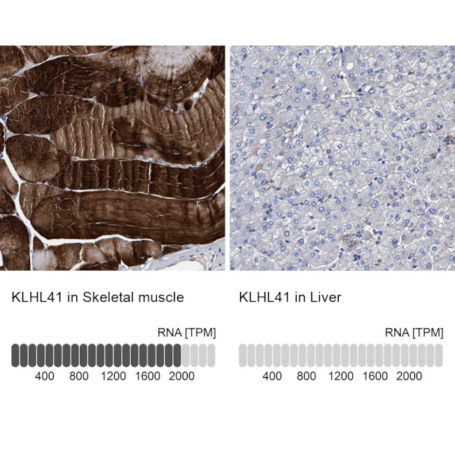 KLHL41 Antibody in Immunohistochemistry (IHC)