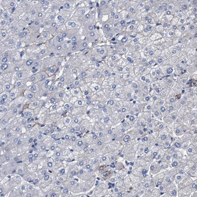 KLHL41 Antibody in Immunohistochemistry (IHC)