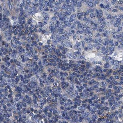 KLHL41 Antibody in Immunohistochemistry (IHC)