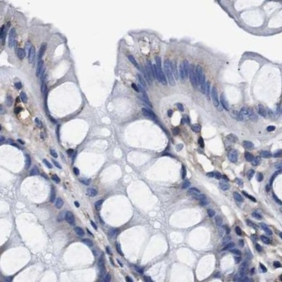 KLHL41 Antibody in Immunohistochemistry (IHC)