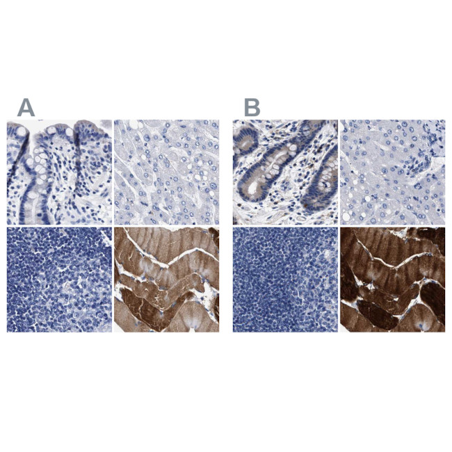 KLHL41 Antibody in Immunohistochemistry (IHC)