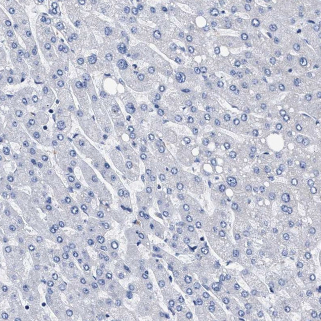 KLHL41 Antibody in Immunohistochemistry (IHC)